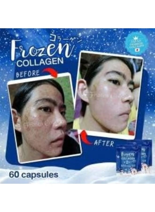 Gluta Frozen Frozen Collagen 2-in-1 Whitening X10 Glutathione - 100% Original - 2 Pieces - Image 3
